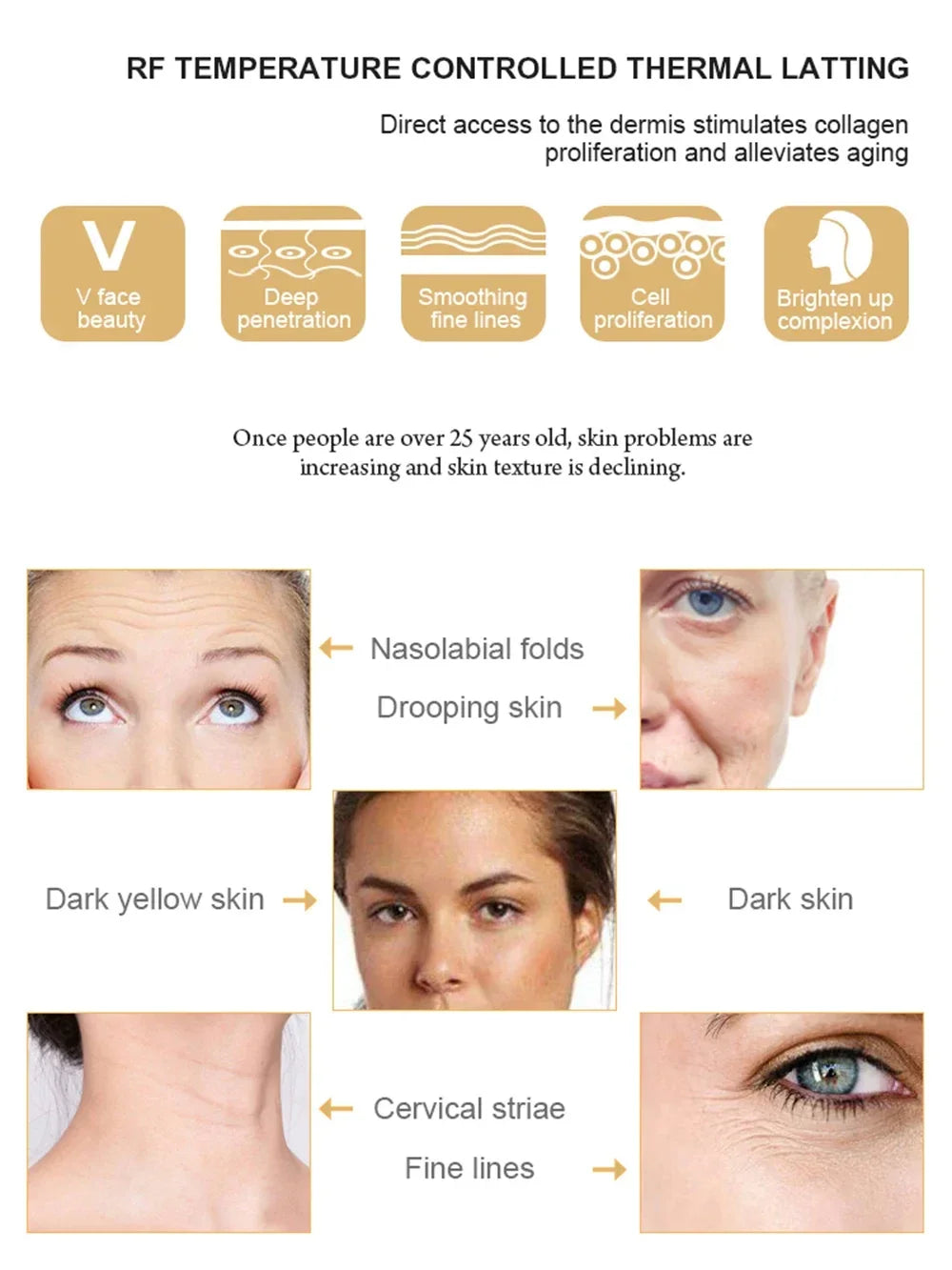 Máquina de levantamento Facial de radiofrequência
