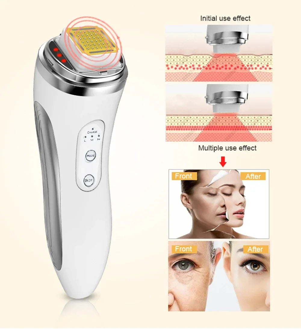 Máquina de levantamento Facial de radiofrequência