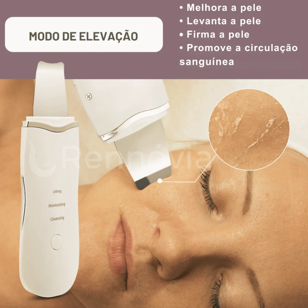 Removedor De Cravos e Limpeza de Pele- Peeling Ultrassonico